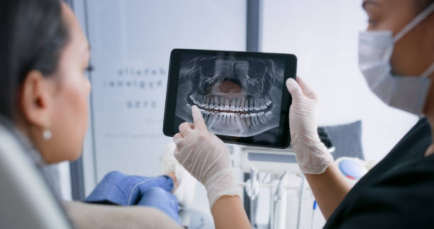 Licensed Tooth Extraction service in Kaysville, UT - Smile Center Dentistry